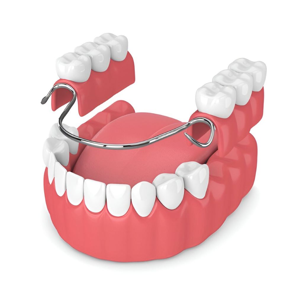 complete partial denture in sw calgary