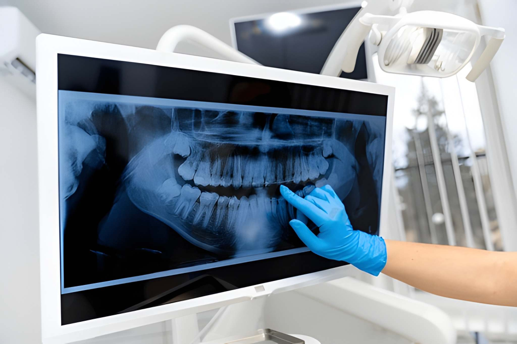 digital x rays near you