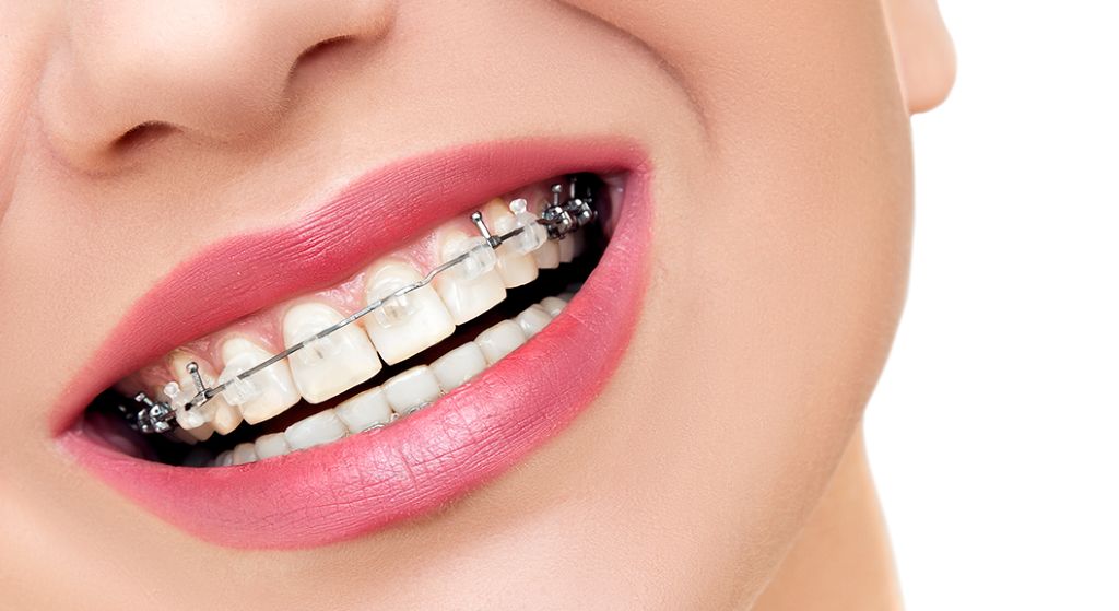 orthodontic post procedure