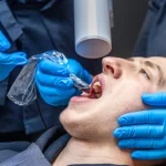 Benefits of Fluoride Treatment for Kids and Adults