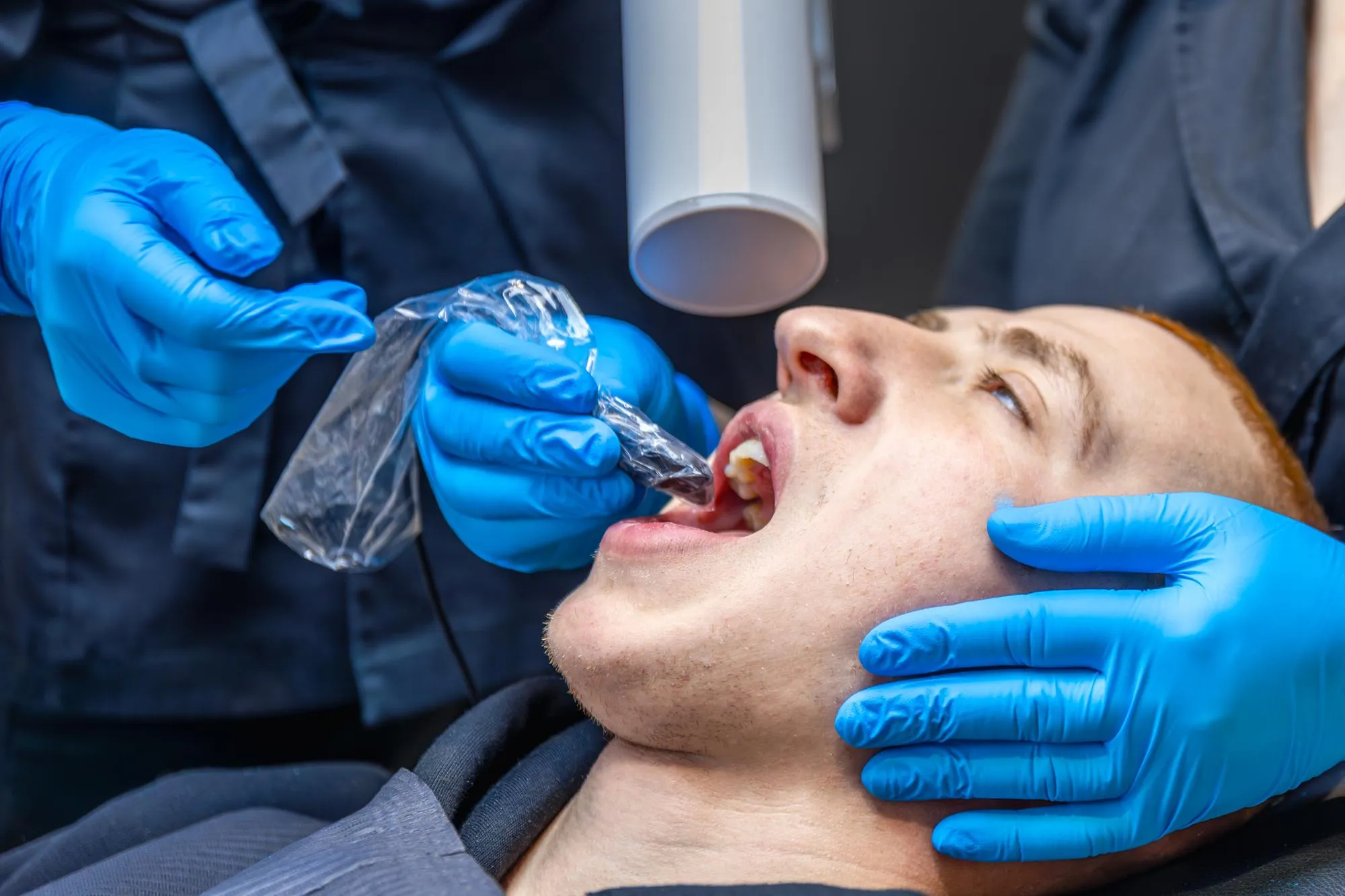 Benefits of Fluoride Treatment for Kids and Adults